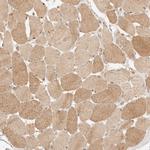 PHLDA3 Antibody in Immunohistochemistry (Paraffin) (IHC (P))