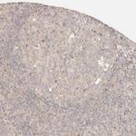 PHLDA3 Antibody in Immunohistochemistry (Paraffin) (IHC (P))