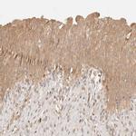 PHLDA3 Antibody in Immunohistochemistry (IHC)
