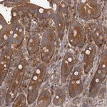 ADAMTS20 Polyclonal Antibody