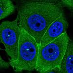 S100A14 Polyclonal Antibody