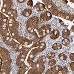 S100A14 Antibody in Immunohistochemistry (Paraffin) (IHC (P))