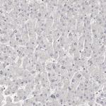 S100A14 Antibody in Immunohistochemistry (Paraffin) (IHC (P))
