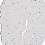 S100A14 Antibody in Immunohistochemistry (Paraffin) (IHC (P))