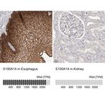 S100A14 Antibody in Immunohistochemistry (IHC)