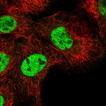 RNF26 Polyclonal Antibody