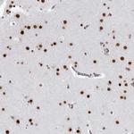 RNF26 Antibody in Immunohistochemistry (Paraffin) (IHC (P))