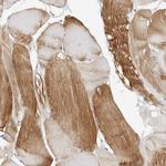 HSPB7 Antibody in Immunohistochemistry (Paraffin) (IHC (P))