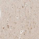 MRPL55 Antibody in Immunohistochemistry (Paraffin) (IHC (P))