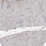 KIF26B Polyclonal Antibody