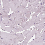 PRR9 Polyclonal Antibody