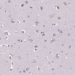 PRR9 Antibody in Immunohistochemistry (Paraffin) (IHC (P))