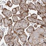 RABIF Polyclonal Antibody