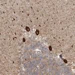 DNAH14 Polyclonal Antibody