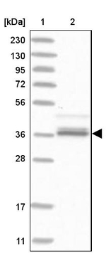 AKR1A1 Antibody in Western Blot (WB)