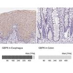 GBP6 Antibody in Immunohistochemistry (IHC)
