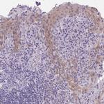 GBP6 Antibody in Immunohistochemistry (IHC)