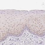 GBP6 Antibody in Immunohistochemistry (IHC)