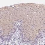 GBP6 Antibody in Immunohistochemistry (IHC)