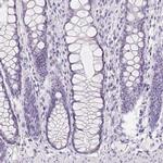 GBP6 Antibody in Immunohistochemistry (IHC)