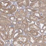 VAC14 Antibody in Immunohistochemistry (Paraffin) (IHC (P))