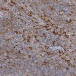 VAC14 Polyclonal Antibody