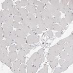 VAC14 Antibody in Immunohistochemistry (Paraffin) (IHC (P))