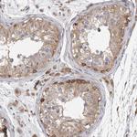 VAC14 Antibody in Immunohistochemistry (Paraffin) (IHC (P))