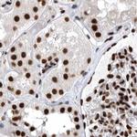 BCLAF1 Antibody in Immunohistochemistry (IHC)