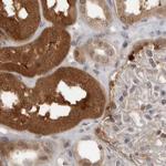 PNPO Antibody in Immunohistochemistry (IHC)