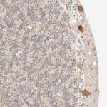 RPS6KL1 Polyclonal Antibody