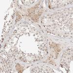 RPS6KL1 Antibody in Immunohistochemistry (Paraffin) (IHC (P))