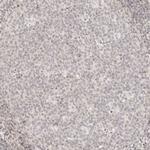 RPS6KL1 Antibody in Immunohistochemistry (Paraffin) (IHC (P))