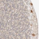 RPS6KL1 Antibody in Immunohistochemistry (IHC)