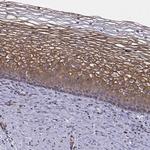 ITGB8 Antibody in Immunohistochemistry (Paraffin) (IHC (P))
