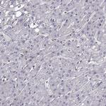 ITGB8 Antibody in Immunohistochemistry (Paraffin) (IHC (P))