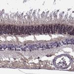 ITGB8 Antibody in Immunohistochemistry (IHC)