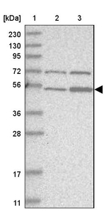 ZFP69 Antibody in Western Blot (WB)