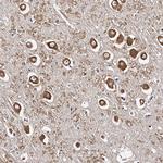 RSC1A1 Antibody in Immunohistochemistry (Paraffin) (IHC (P))