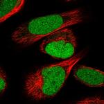 IRF2BP2 Polyclonal Antibody