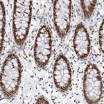 IRF2BP2 Antibody in Immunohistochemistry (Paraffin) (IHC (P))