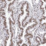 IRF2BP2 Antibody in Immunohistochemistry (Paraffin) (IHC (P))