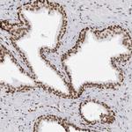 IRF2BP2 Antibody in Immunohistochemistry (Paraffin) (IHC (P))