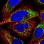 P4HA2 Polyclonal Antibody