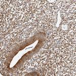 P4HA2 Antibody in Immunohistochemistry (Paraffin) (IHC (P))