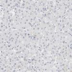 P4HA2 Antibody in Immunohistochemistry (Paraffin) (IHC (P))