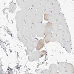 P4HA2 Antibody in Immunohistochemistry (IHC)