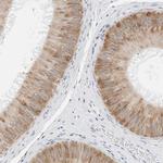 P4HA2 Antibody in Immunohistochemistry (IHC)