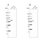 P4HA2 Antibody in Western Blot (WB)