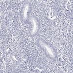 TSSK1 Antibody in Immunohistochemistry (IHC)